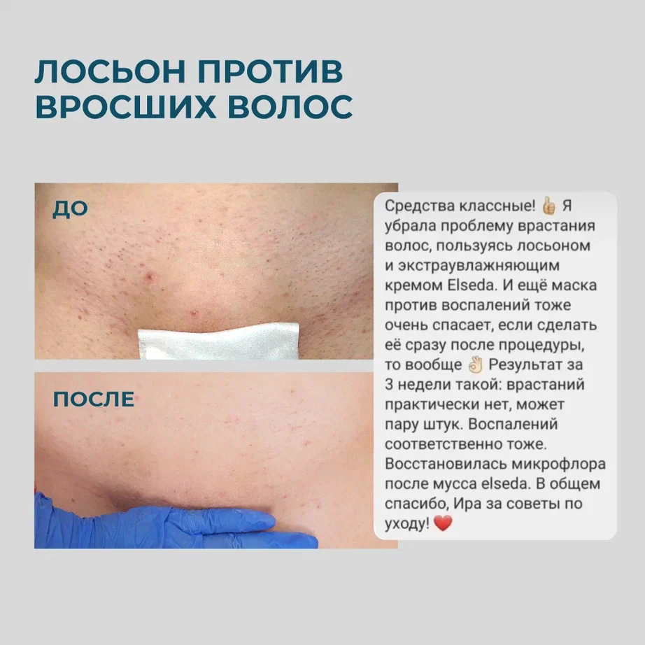 лосьон 3